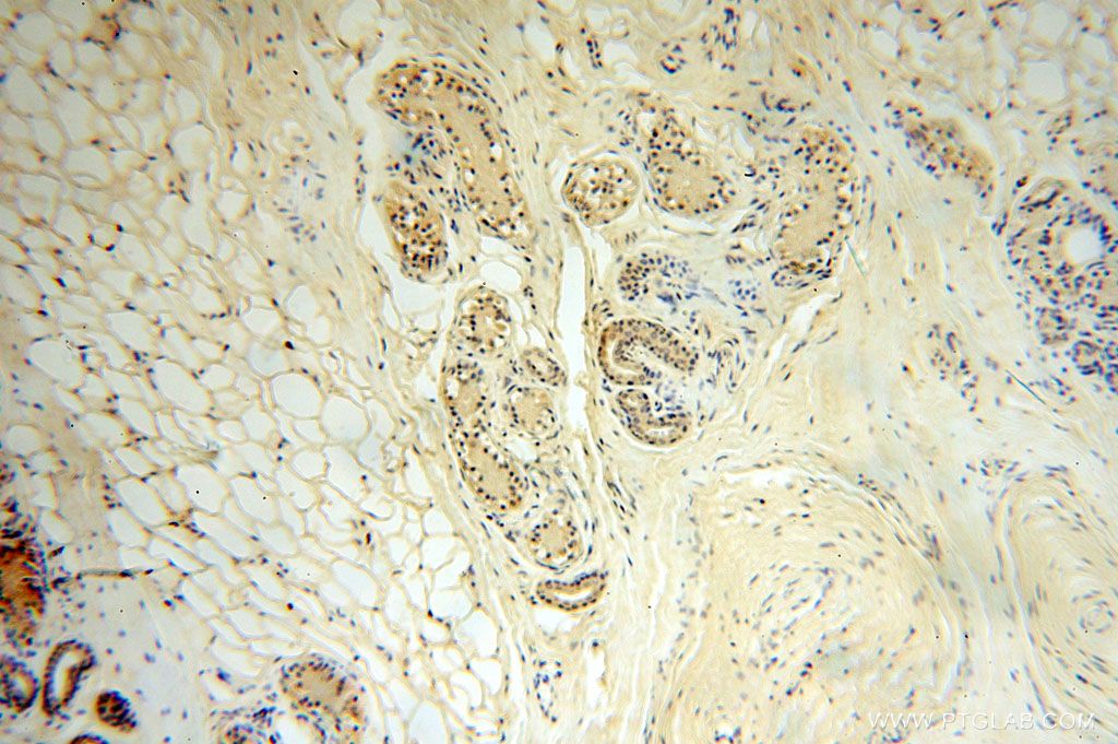 IHC staining of human skin using 16656-1-AP