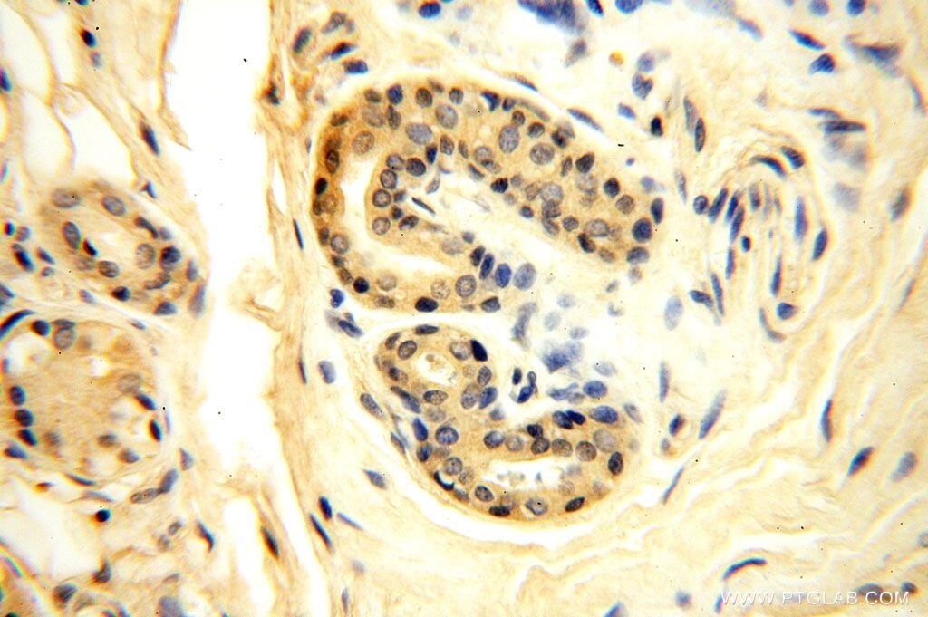 IHC staining of human skin using 16656-1-AP