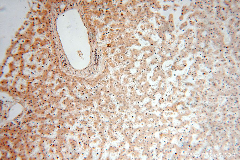 IHC staining of human liver using 16656-1-AP