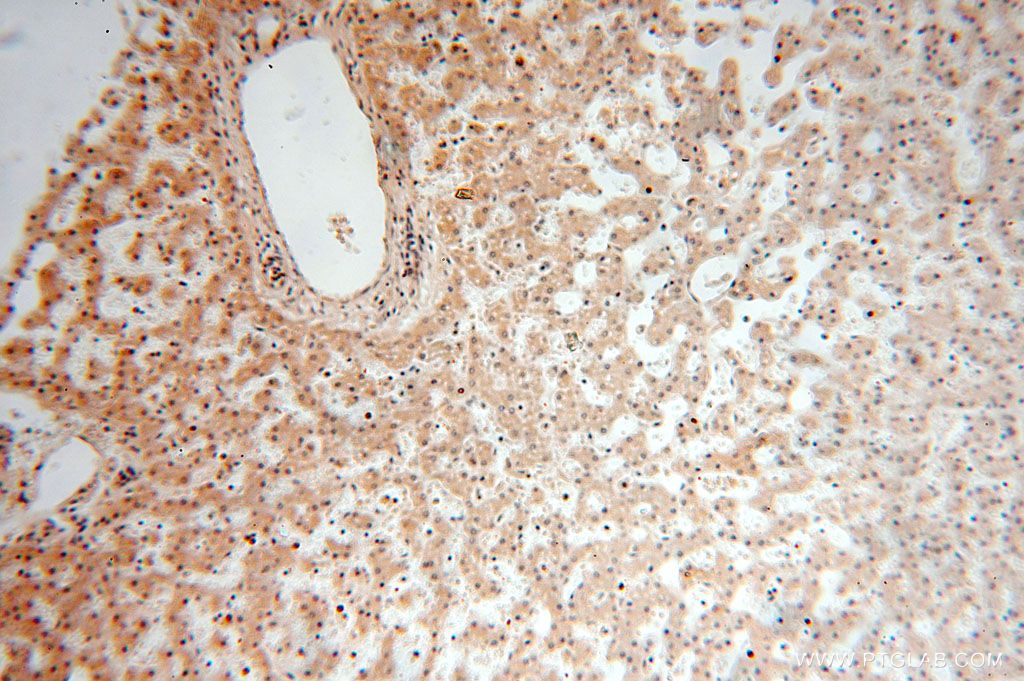 Immunohistochemistry (IHC) staining of human liver tissue using SPATA19 Polyclonal antibody (16656-1-AP)