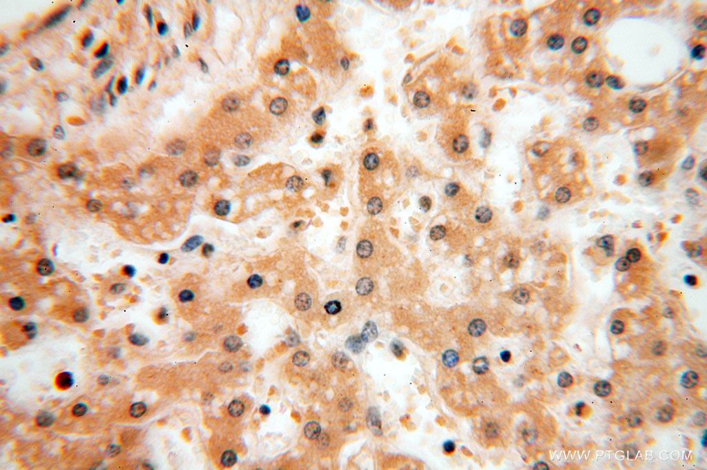Immunohistochemistry (IHC) staining of human liver tissue using SPATA19 Polyclonal antibody (16656-1-AP)