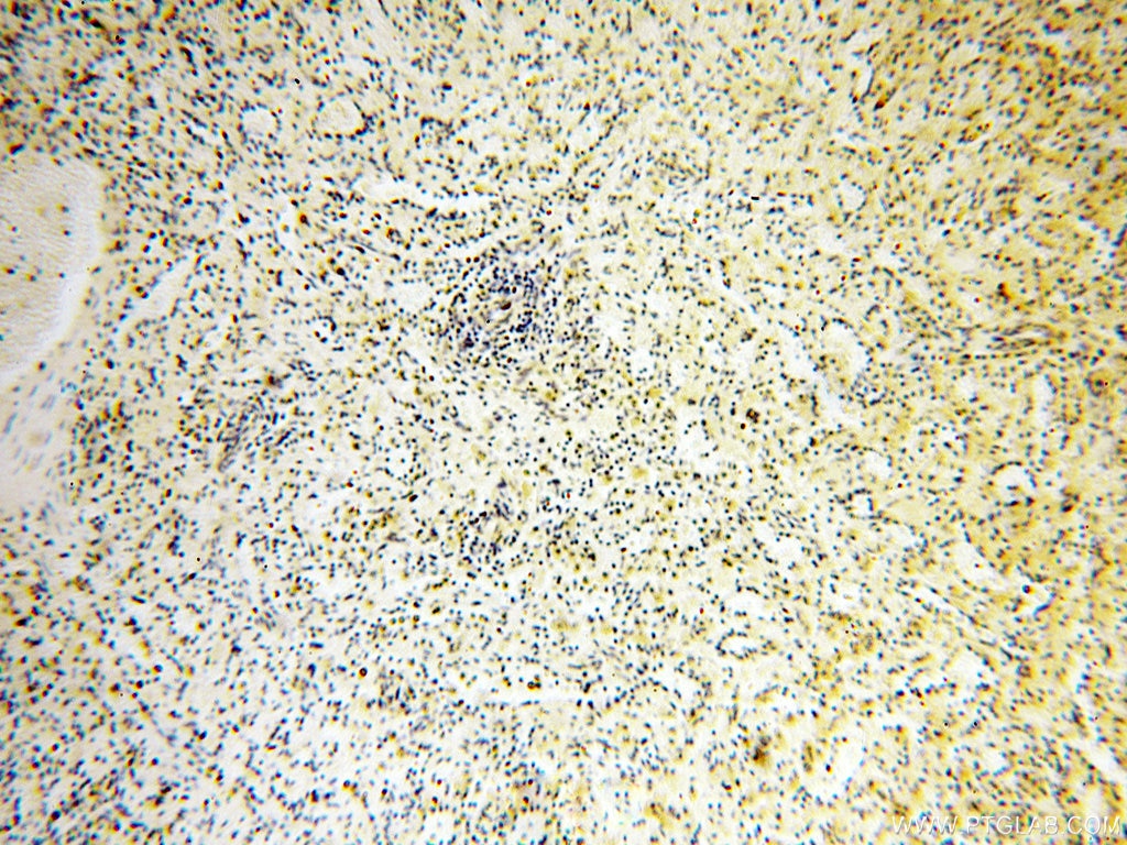 Immunohistochemistry (IHC) staining of human spleen tissue using SPATA19 Polyclonal antibody (16656-1-AP)