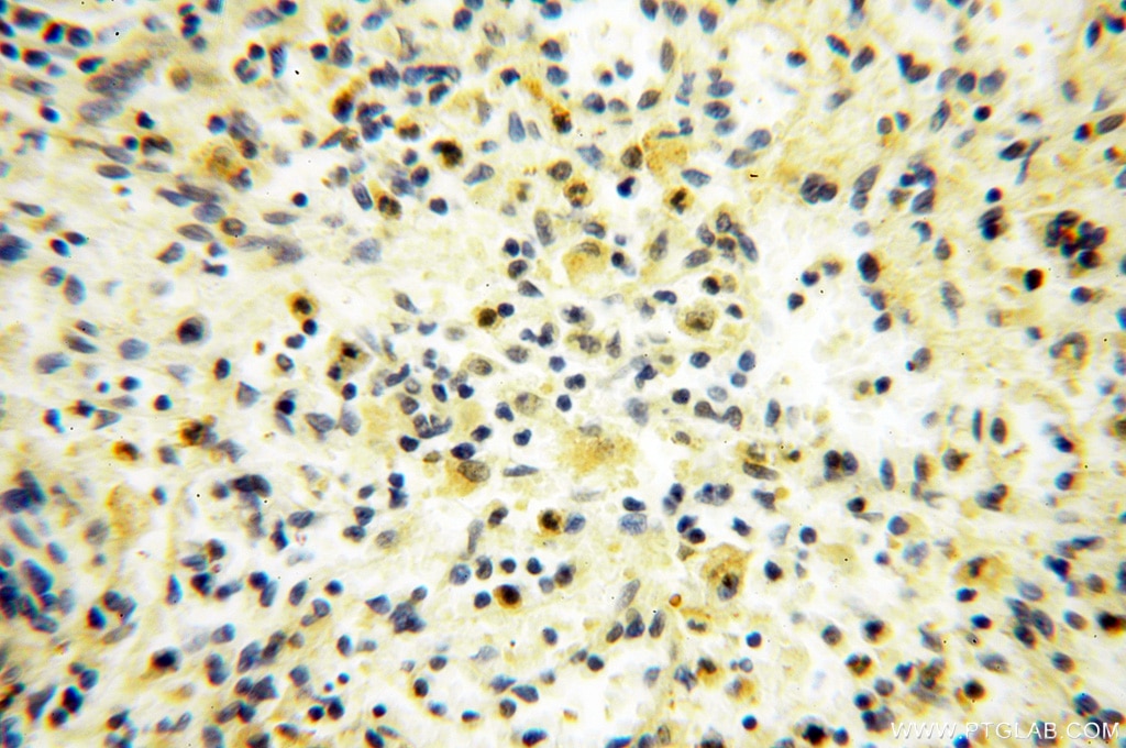 Immunohistochemistry (IHC) staining of human spleen tissue using SPATA19 Polyclonal antibody (16656-1-AP)