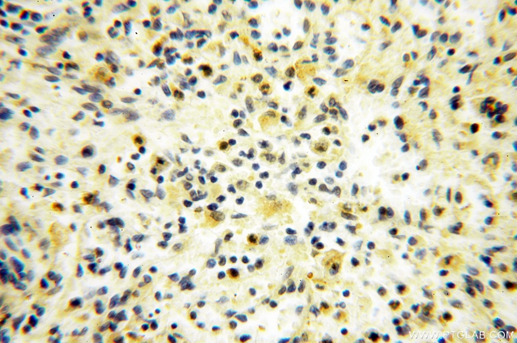 IHC staining of human spleen using 16656-1-AP