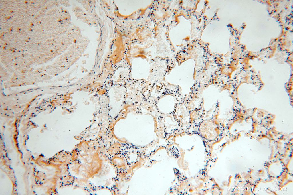 Immunohistochemistry (IHC) staining of human lung tissue using SPATA19 Polyclonal antibody (16656-1-AP)