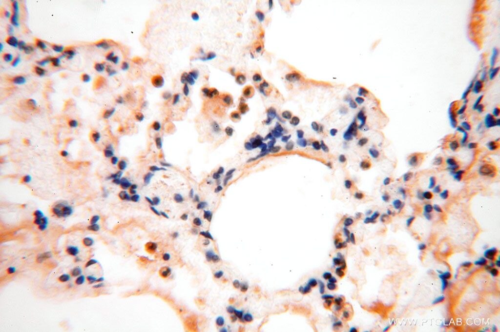Immunohistochemistry (IHC) staining of human lung tissue using SPATA19 Polyclonal antibody (16656-1-AP)