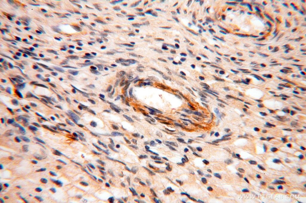 Immunohistochemistry (IHC) staining of human ovary tissue using SPATA19 Polyclonal antibody (16656-1-AP)