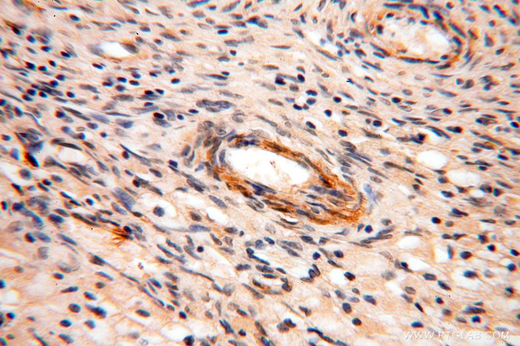 IHC staining of human ovary using 16656-1-AP