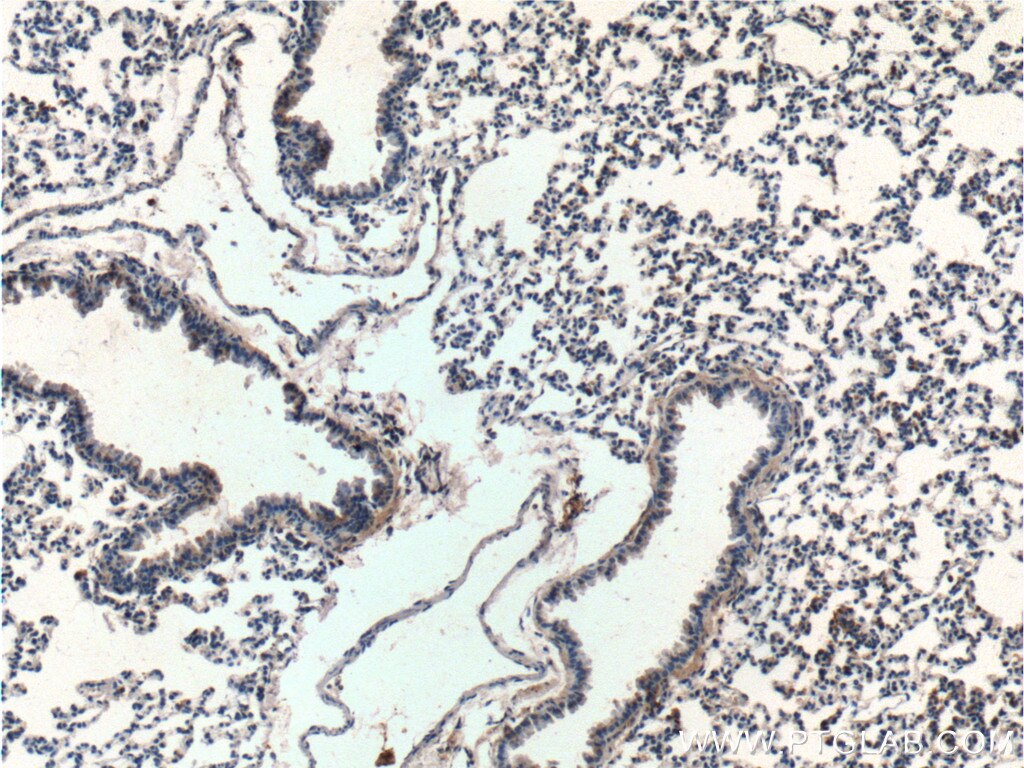 Immunohistochemistry (IHC) staining of mouse lung tissue using SPATA2 Polyclonal antibody (11000-1-AP)