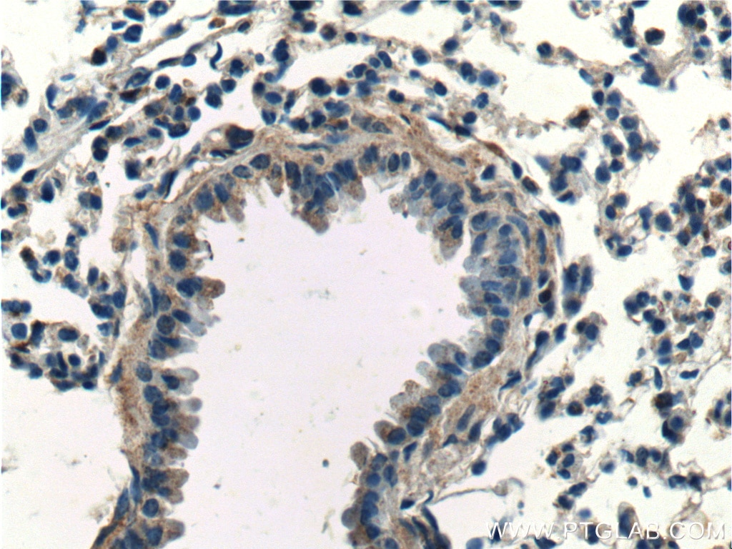 Immunohistochemistry (IHC) staining of mouse lung tissue using SPATA2 Polyclonal antibody (11000-1-AP)