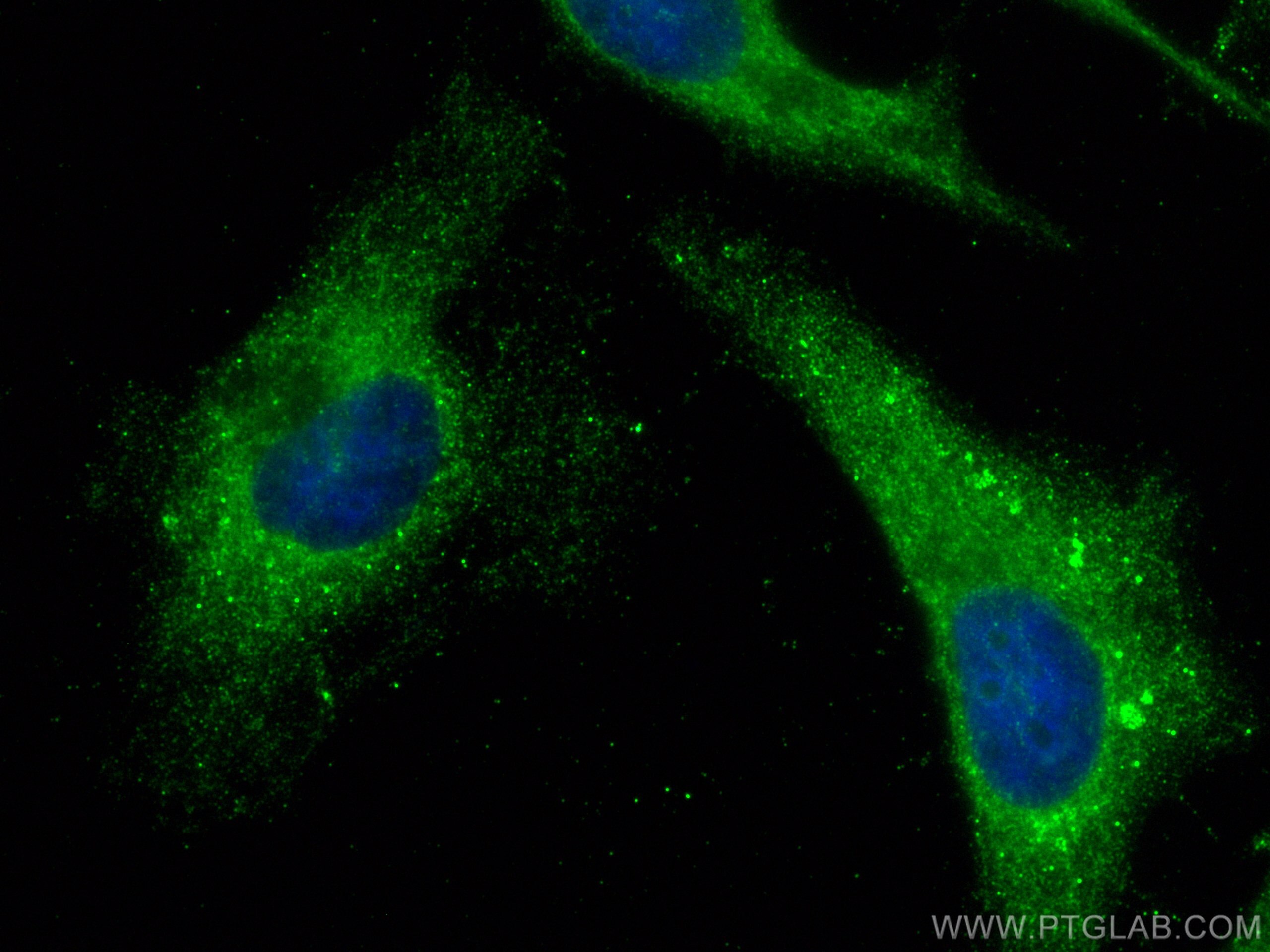 Immunofluorescence (IF) / fluorescent staining of HeLa cells using SPATA2 Polyclonal antibody (29321-1-AP)