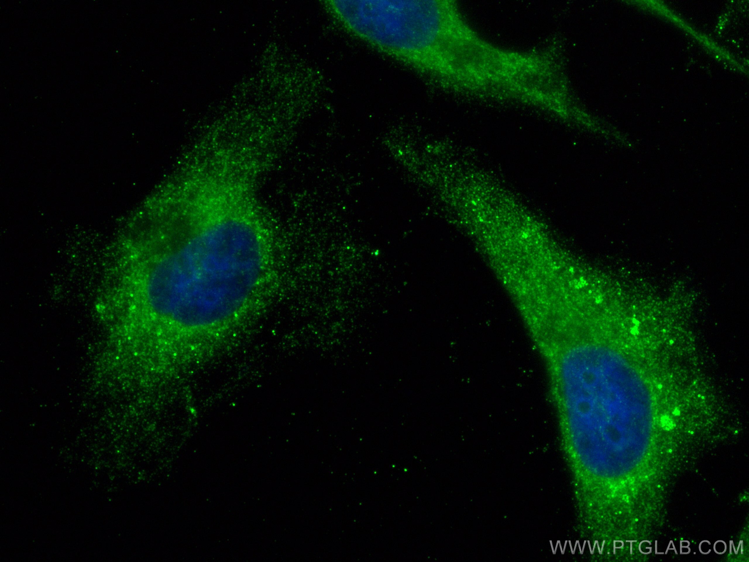 IF Staining of HeLa using 29321-1-AP