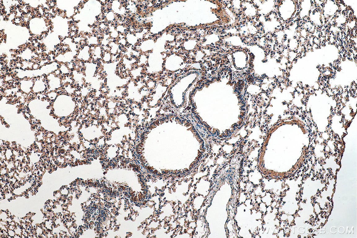 Immunohistochemistry (IHC) staining of mouse lung tissue using SPATA2 Polyclonal antibody (29321-1-AP)