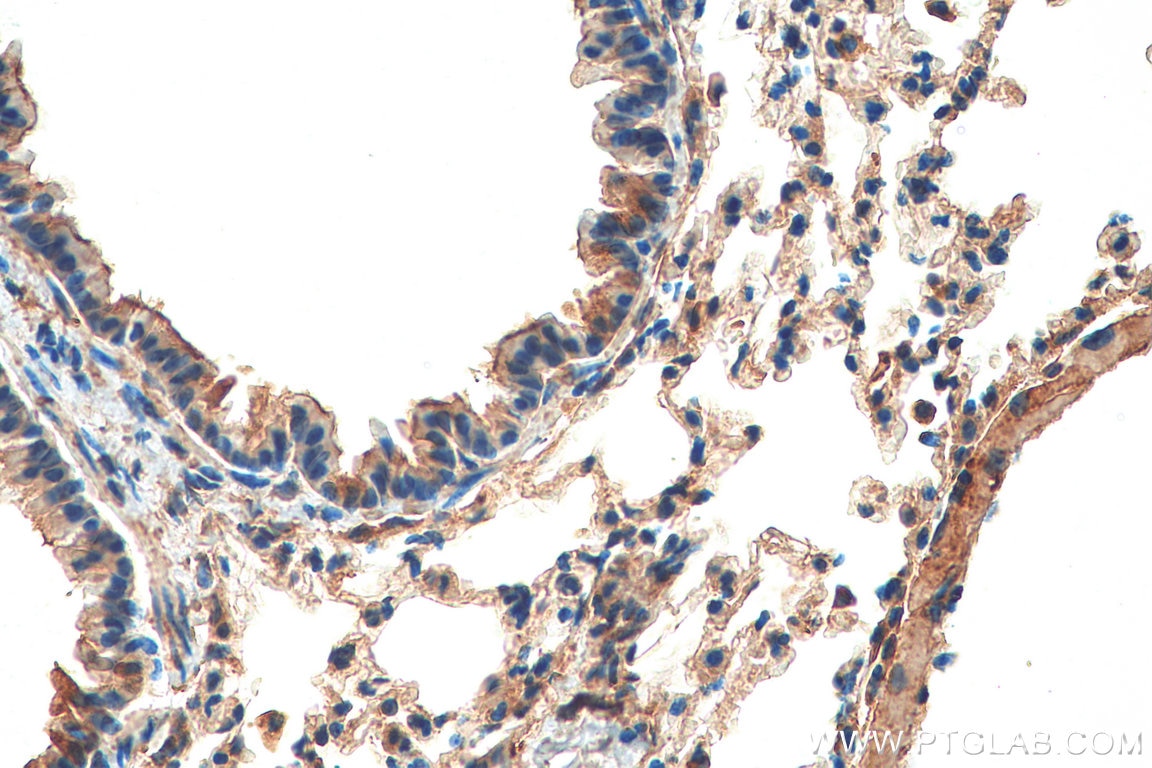 Immunohistochemistry (IHC) staining of mouse lung tissue using SPATA2 Polyclonal antibody (29321-1-AP)