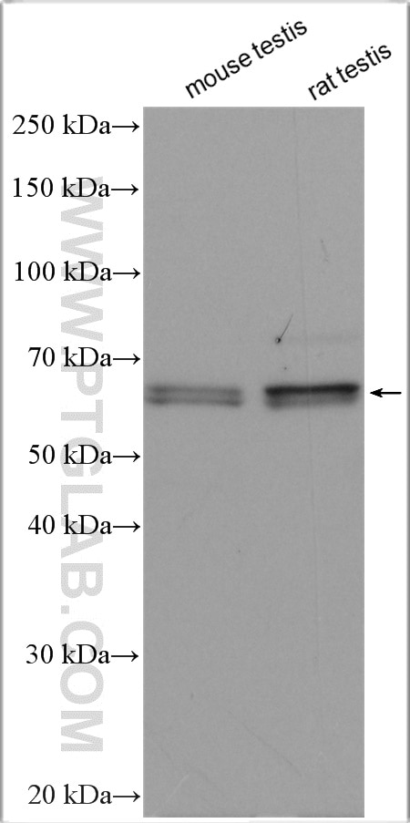 Western Blot (WB) analysis of various lysates using SPATA2 Polyclonal antibody (29321-1-AP)