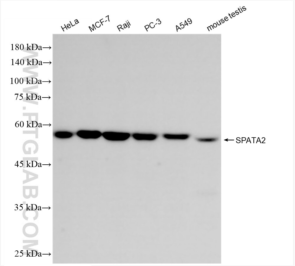 Western Blot (WB) analysis of various lysates using SPATA2 Recombinant antibody (85712-1-RR)