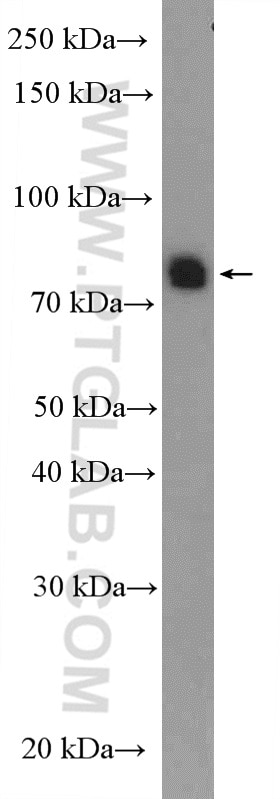 Western Blot (WB) analysis of rat testis tissue using SPATA20 Polyclonal antibody (18373-1-AP)