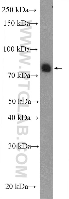 Western Blot (WB) analysis of rat testis tissue using SPATA20 Polyclonal antibody (18373-1-AP)