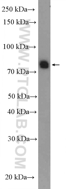 Western Blot (WB) analysis of rat testis tissue using SPATA20 Polyclonal antibody (18373-1-AP)