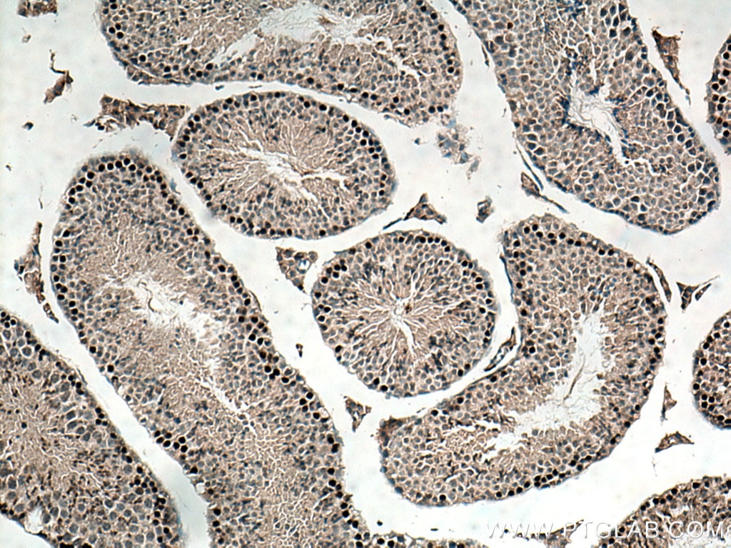 IHC staining of mouse testis using 16989-1-AP