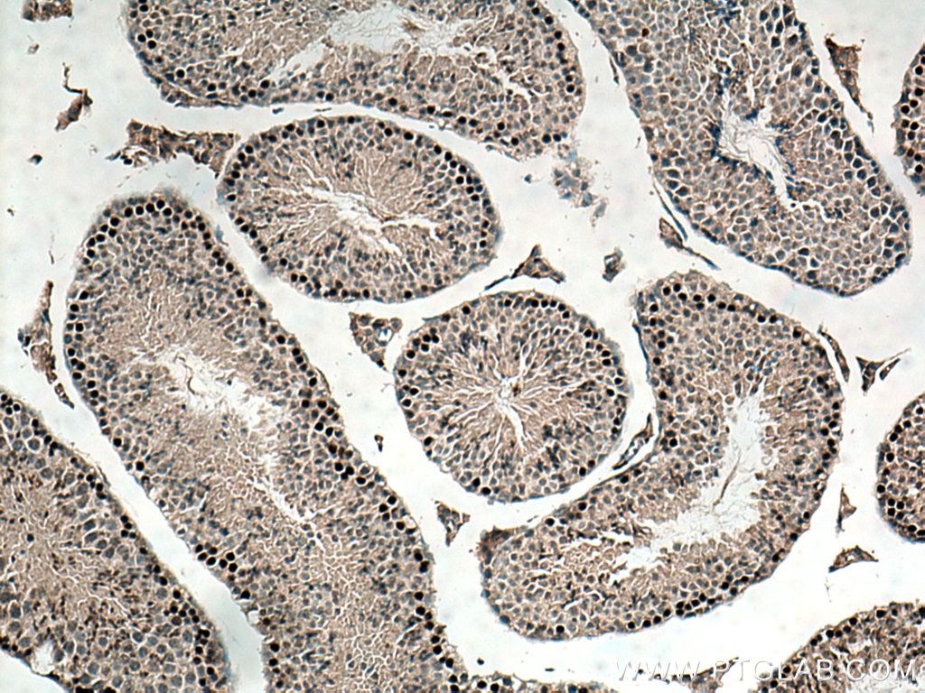 Immunohistochemistry (IHC) staining of mouse testis tissue using SPATA22 Polyclonal antibody (16989-1-AP)