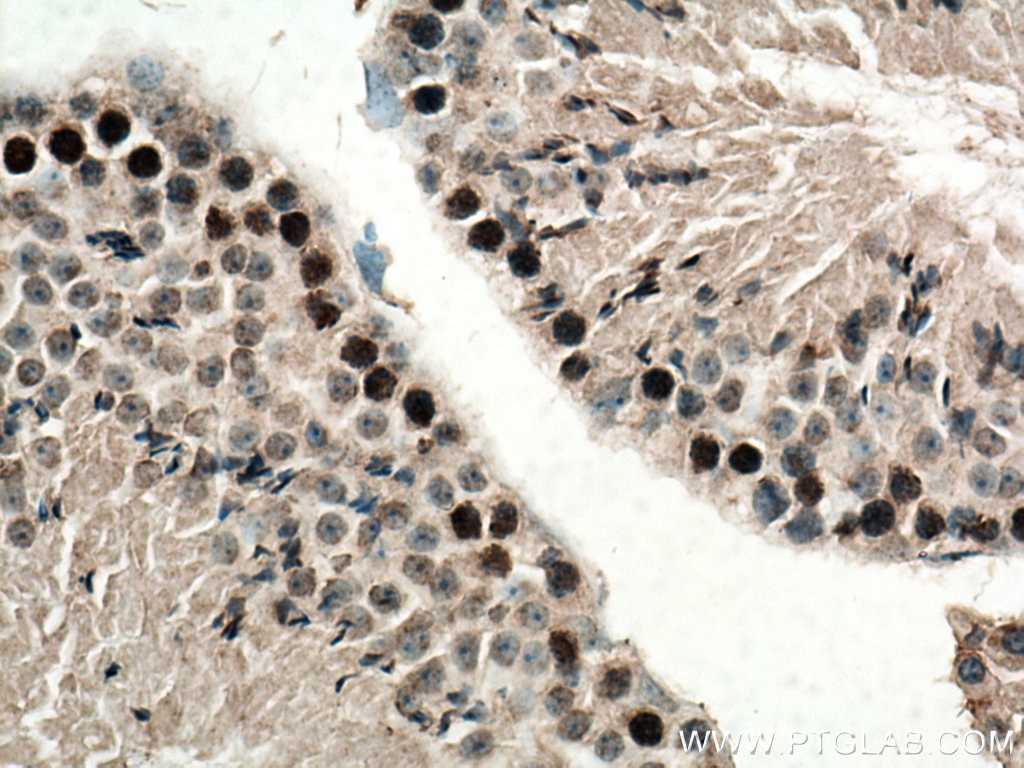 Immunohistochemistry (IHC) staining of mouse testis tissue using SPATA22 Polyclonal antibody (16989-1-AP)