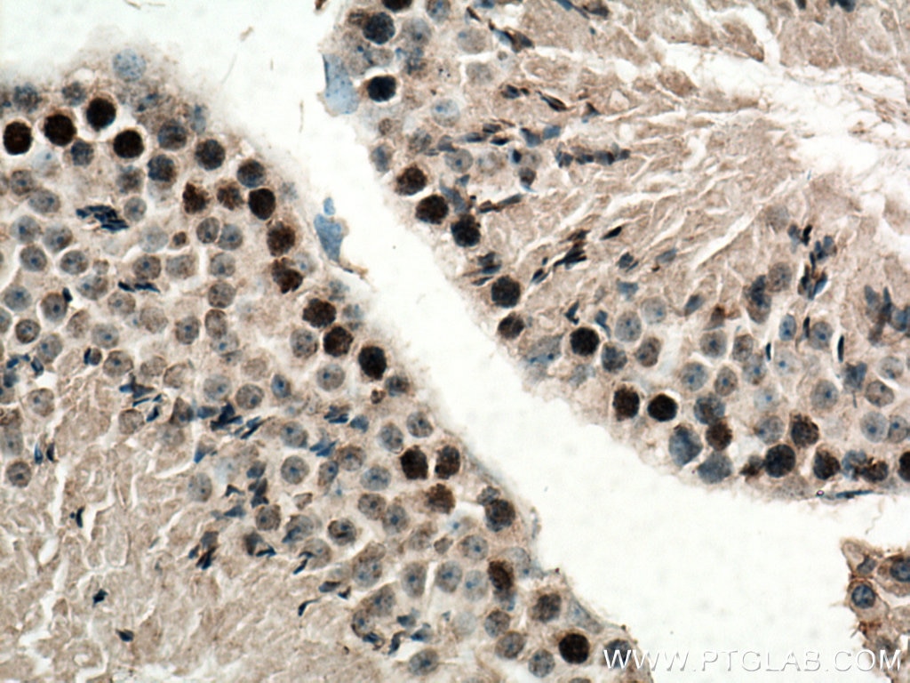 IHC staining of mouse testis using 16989-1-AP