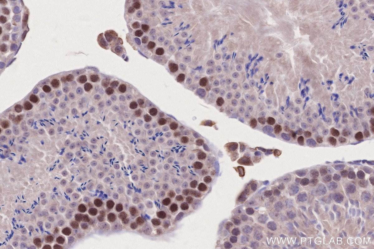 Immunohistochemistry (IHC) staining of mouse testis tissue using SPATA22 Polyclonal antibody (16989-1-AP)