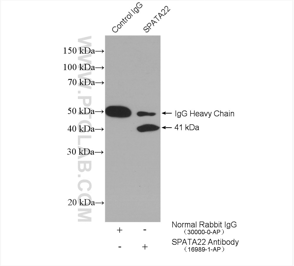 Immunoprecipitation (IP) experiment of mouse testis tissue using SPATA22 Polyclonal antibody (16989-1-AP)
