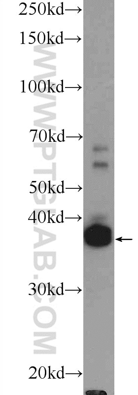 WB analysis of mouse testis using 16989-1-AP