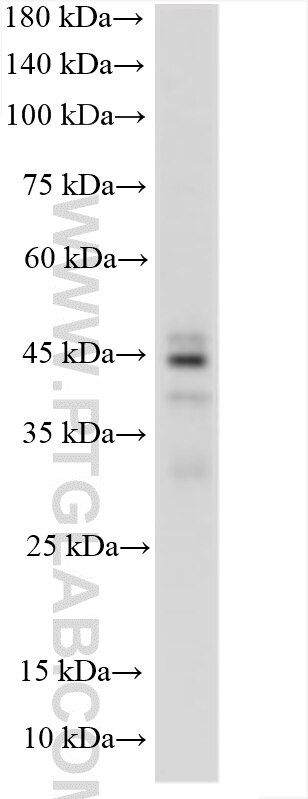 Western Blot (WB) analysis of various lysates using SPATA22 Polyclonal antibody (16989-1-AP)