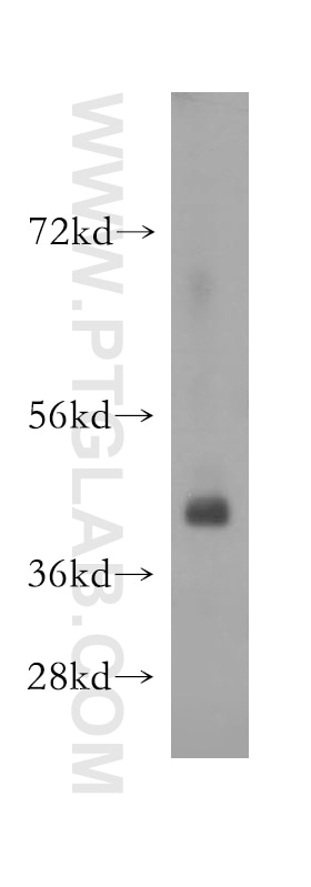 Western Blot (WB) analysis of human testis tissue using SPATA22 Polyclonal antibody (16989-1-AP)