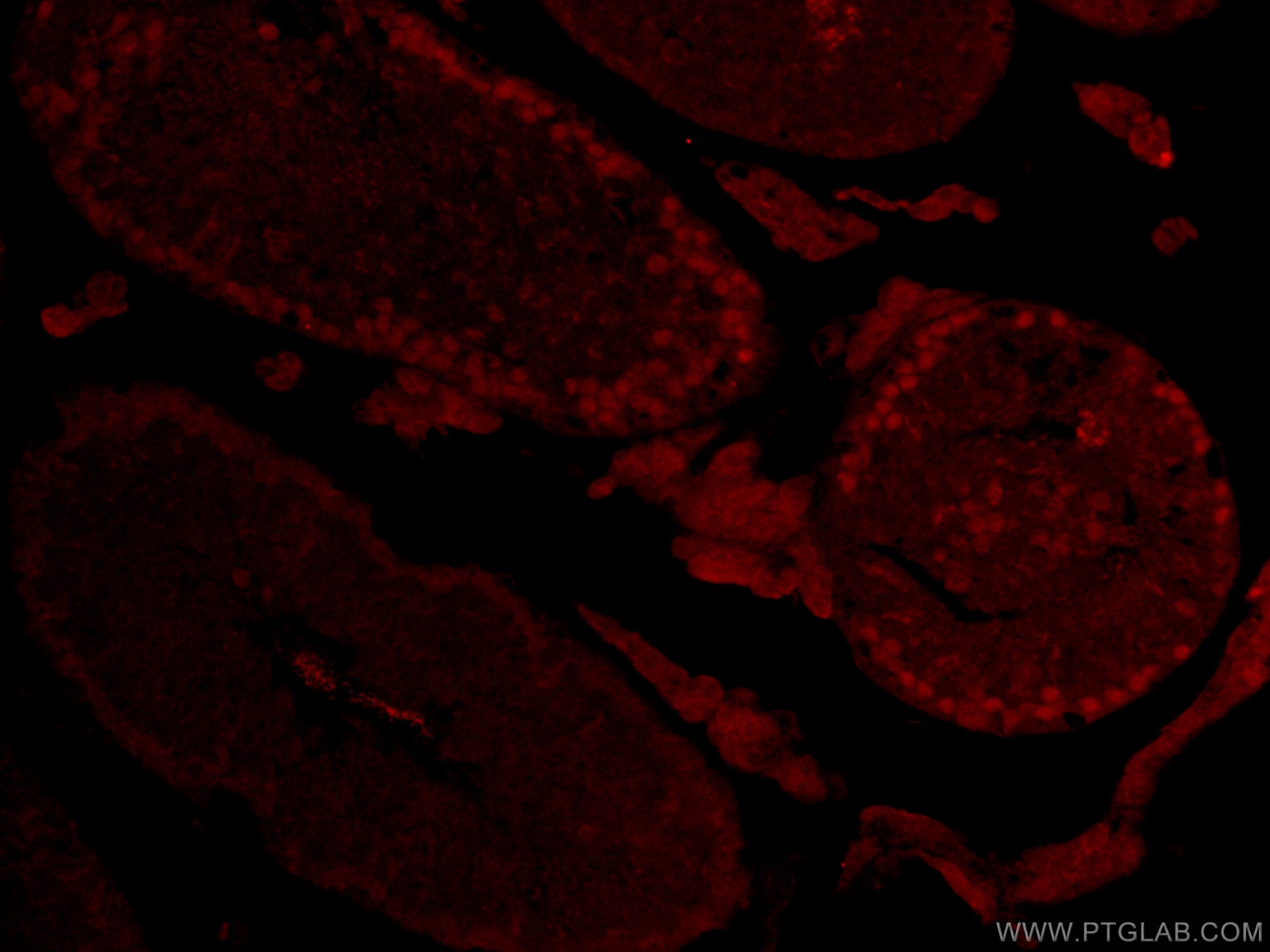 IF Staining of mouse testis using CL594-16989