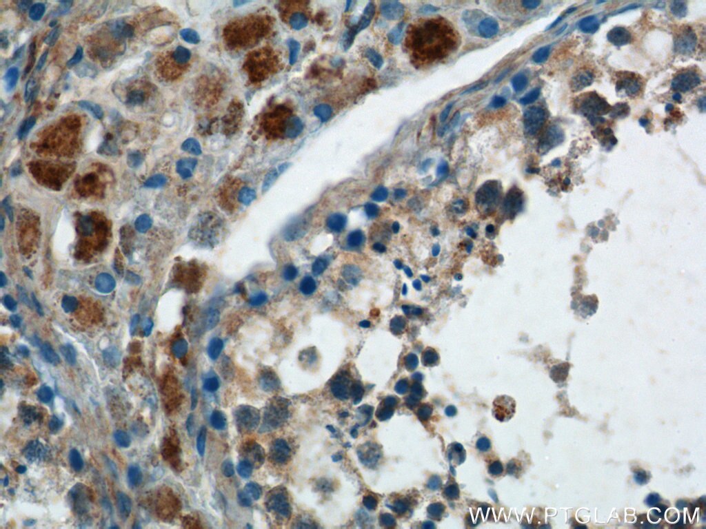 Immunohistochemistry (IHC) staining of human testis tissue using SPATA3 Polyclonal antibody (17500-1-AP)