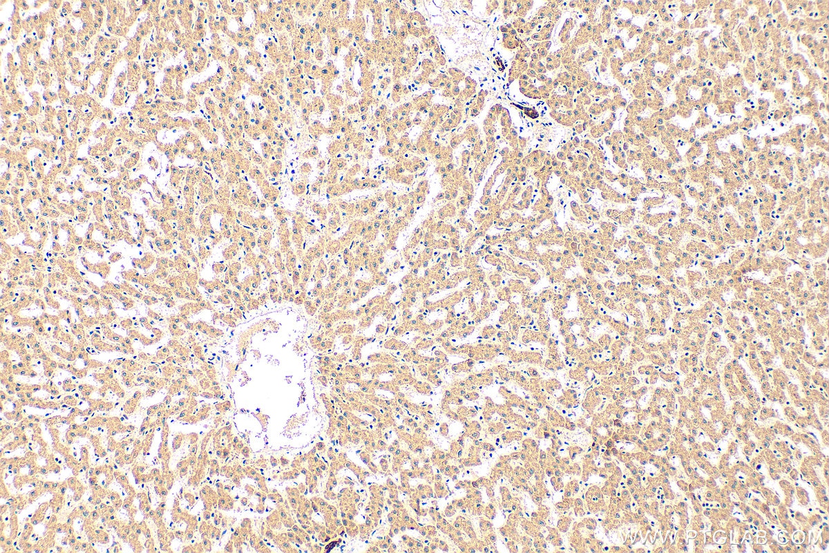 Immunohistochemistry (IHC) staining of human liver tissue using SPATA5 Polyclonal antibody (32104-1-AP)