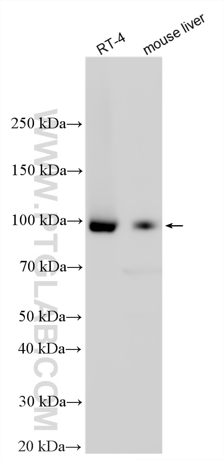 WB analysis using 32104-1-AP Western Blot (WB) analysis of various lysates using SPATA5 Polyclonal antibody (32104-1-AP)