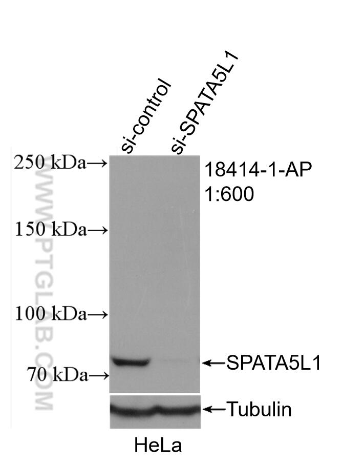 Western Blot (WB) analysis of HeLa cells using SPATA5L1 Polyclonal antibody (18414-1-AP)