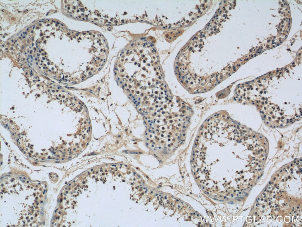 Immunohistochemistry (IHC) staining of human testis tissue using SPATA6 Polyclonal antibody (11849-1-AP)