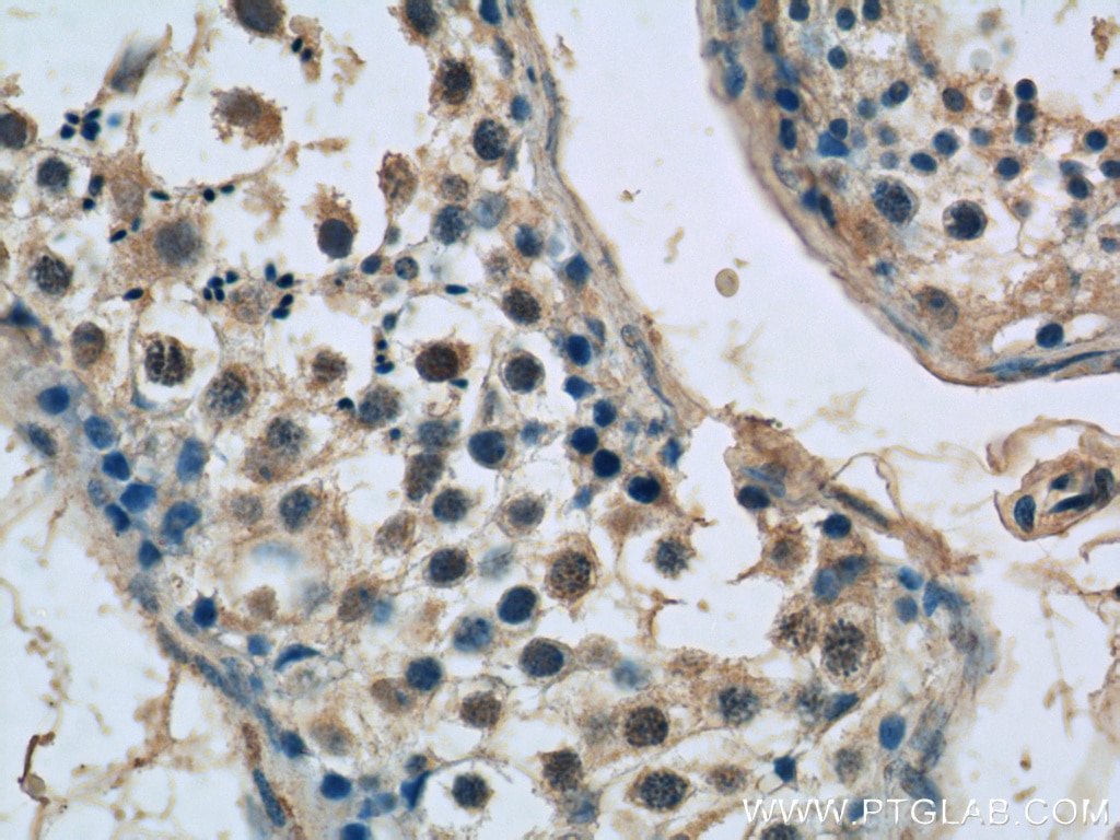 Immunohistochemistry (IHC) staining of human testis tissue using SPATA6 Polyclonal antibody (11849-1-AP)