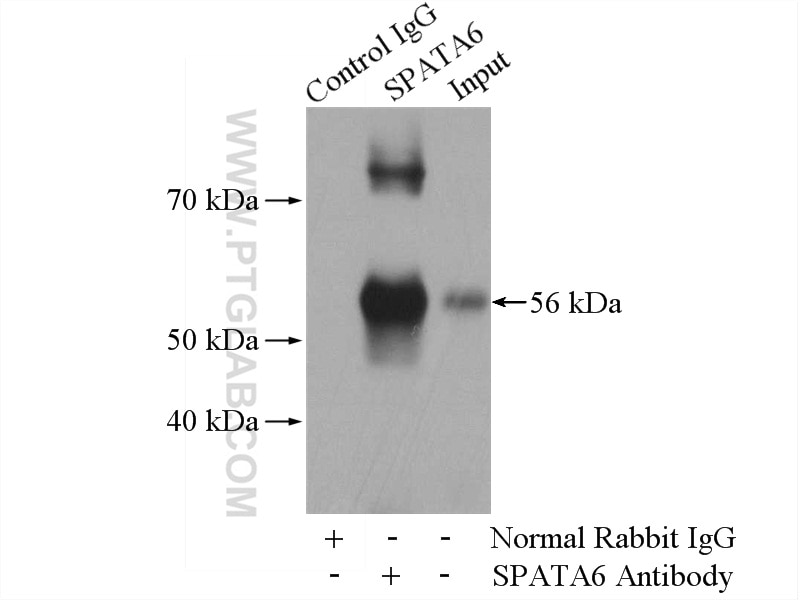 Immunoprecipitation (IP) experiment of mouse testis tissue using SPATA6 Polyclonal antibody (11849-1-AP)