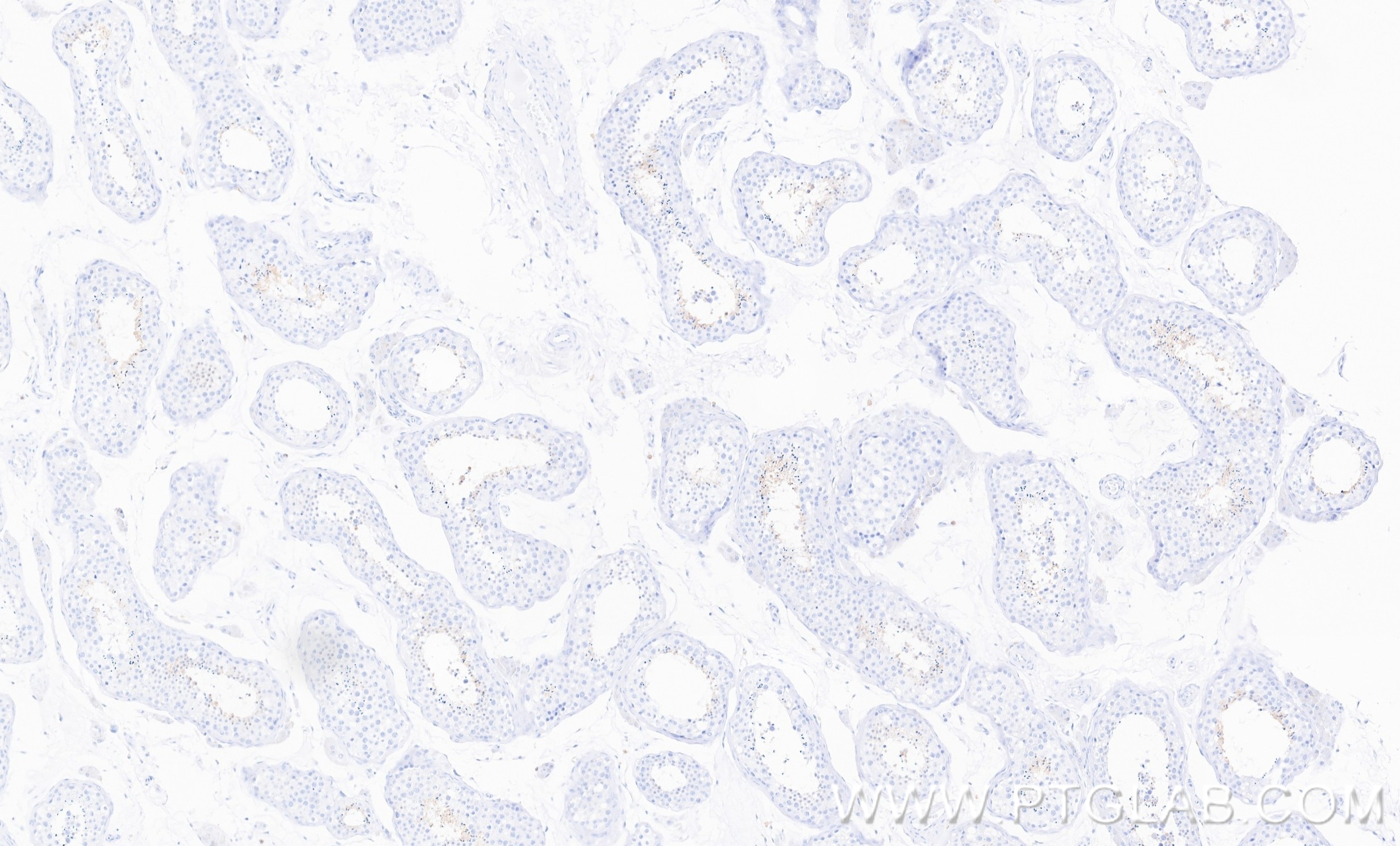 Immunohistochemistry (IHC) staining of human testis tissue using SPATA6 Recombinant monoclonal antibody (87341-1-RR)