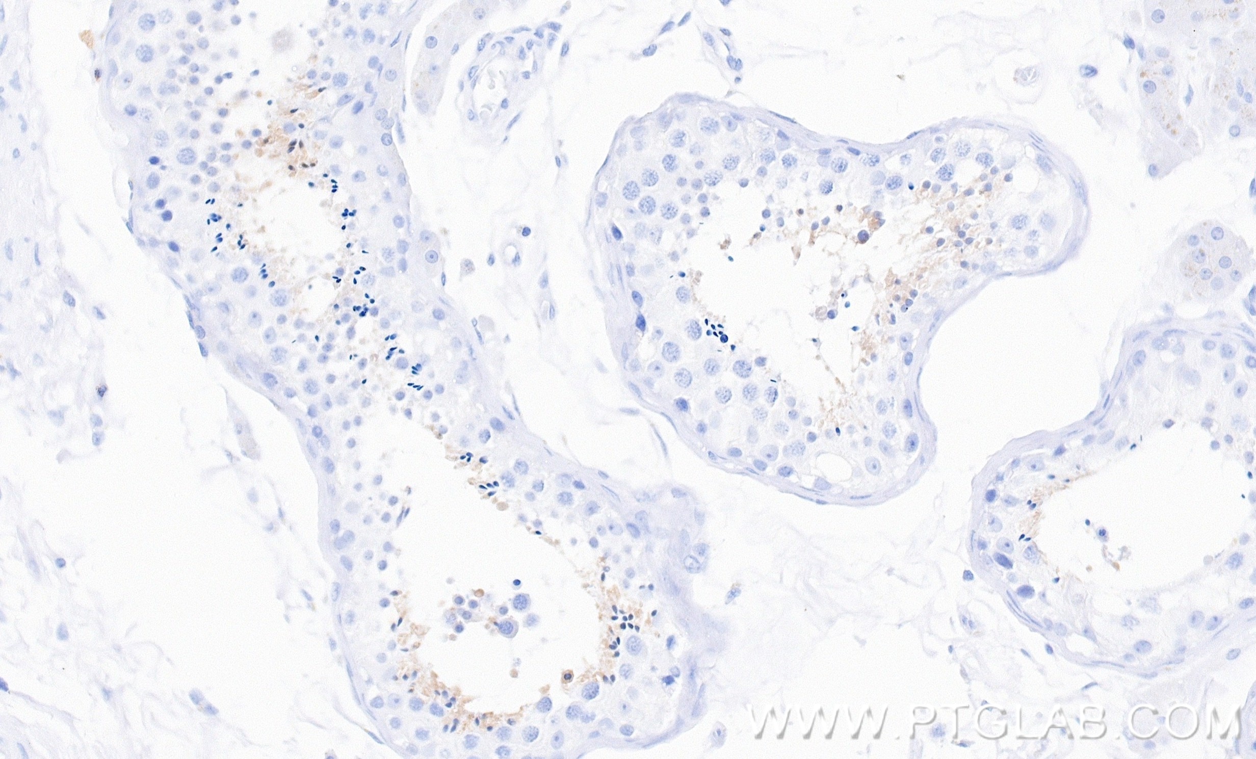 Immunohistochemistry (IHC) staining of human testis tissue using SPATA6 Recombinant monoclonal antibody (87341-1-RR)