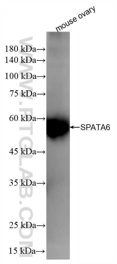 WB analysis of mouse ovary using 87341-1-RR (same clone as 87341-1-PBS) Western Blot (WB) analysis of mouse ovary tissue using SPATA6 Recombinant monoclonal antibody (87341-1-RR)