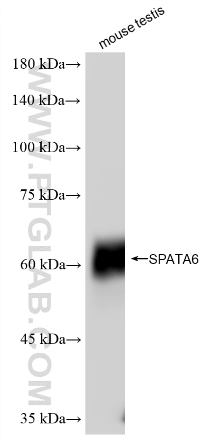 WB analysis of mouse testis using 87341-1-RR (same clone as 87341-1-PBS) Western Blot (WB) analysis of mouse testis tissue using SPATA6 Recombinant monoclonal antibody (87341-1-RR)