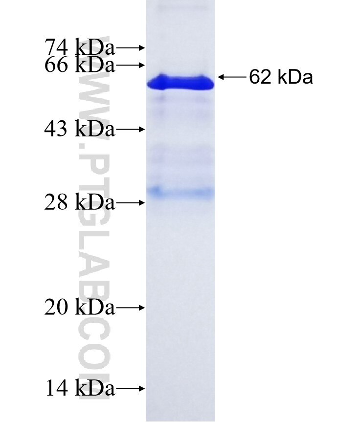 SPATA6 fusion protein Ag2413 SDS-PAGE
