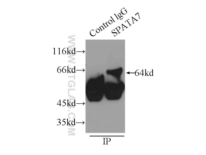 Immunoprecipitation (IP) experiment of mouse testis tissue using SPATA7 Polyclonal antibody (12020-1-AP)