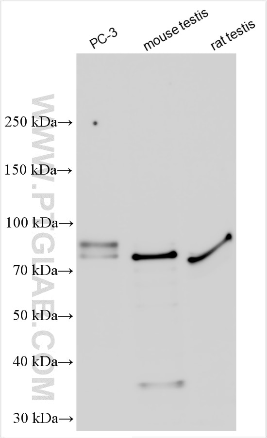 Western Blot (WB) analysis of various lysates using SPATA7 Polyclonal antibody (12020-1-AP)