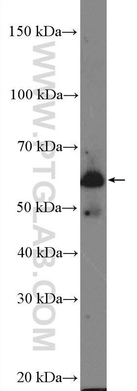 WB analysis of human testis using 25861-1-AP