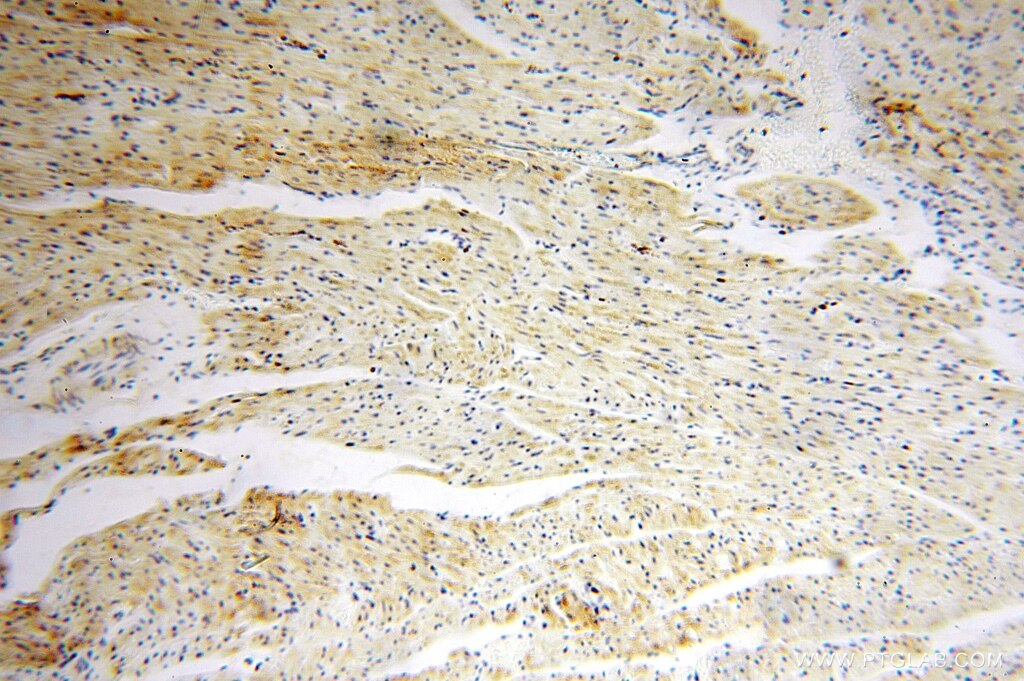 Immunohistochemistry (IHC) staining of human heart tissue using SPATS2L Polyclonal antibody (16938-1-AP)