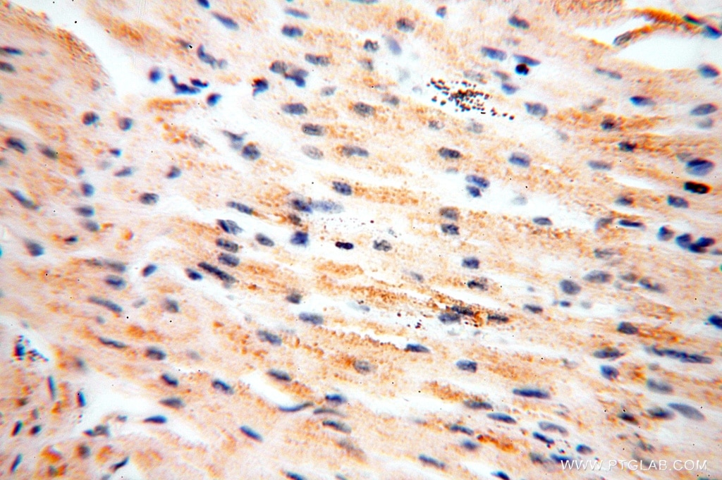 Immunohistochemistry (IHC) staining of human heart tissue using SPATS2L Polyclonal antibody (16938-1-AP)